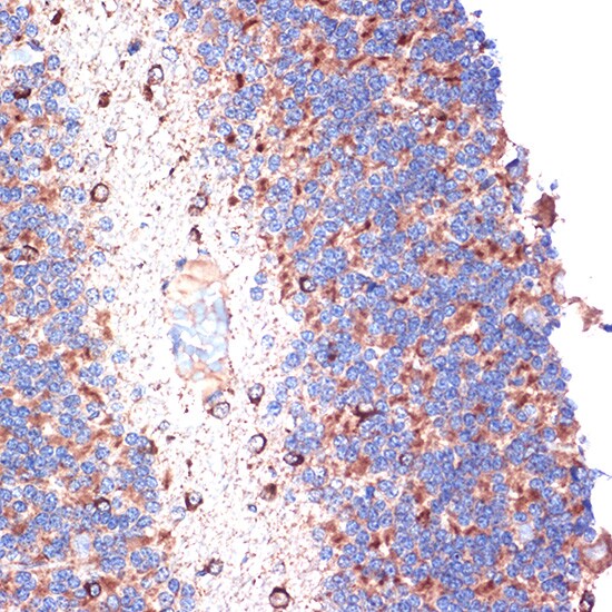 TTC11 Antibody (6S1G4)