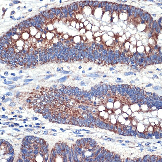 TTC11 Antibody (6S1G4)