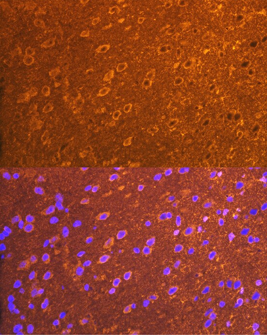 PSD93 Antibody (0G4O6)