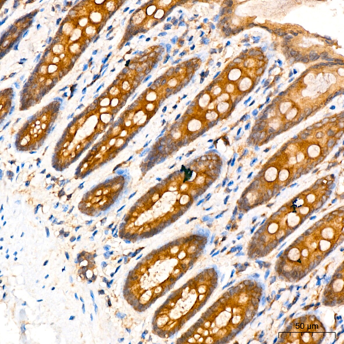 ATG5 Antibody (8L7X6)