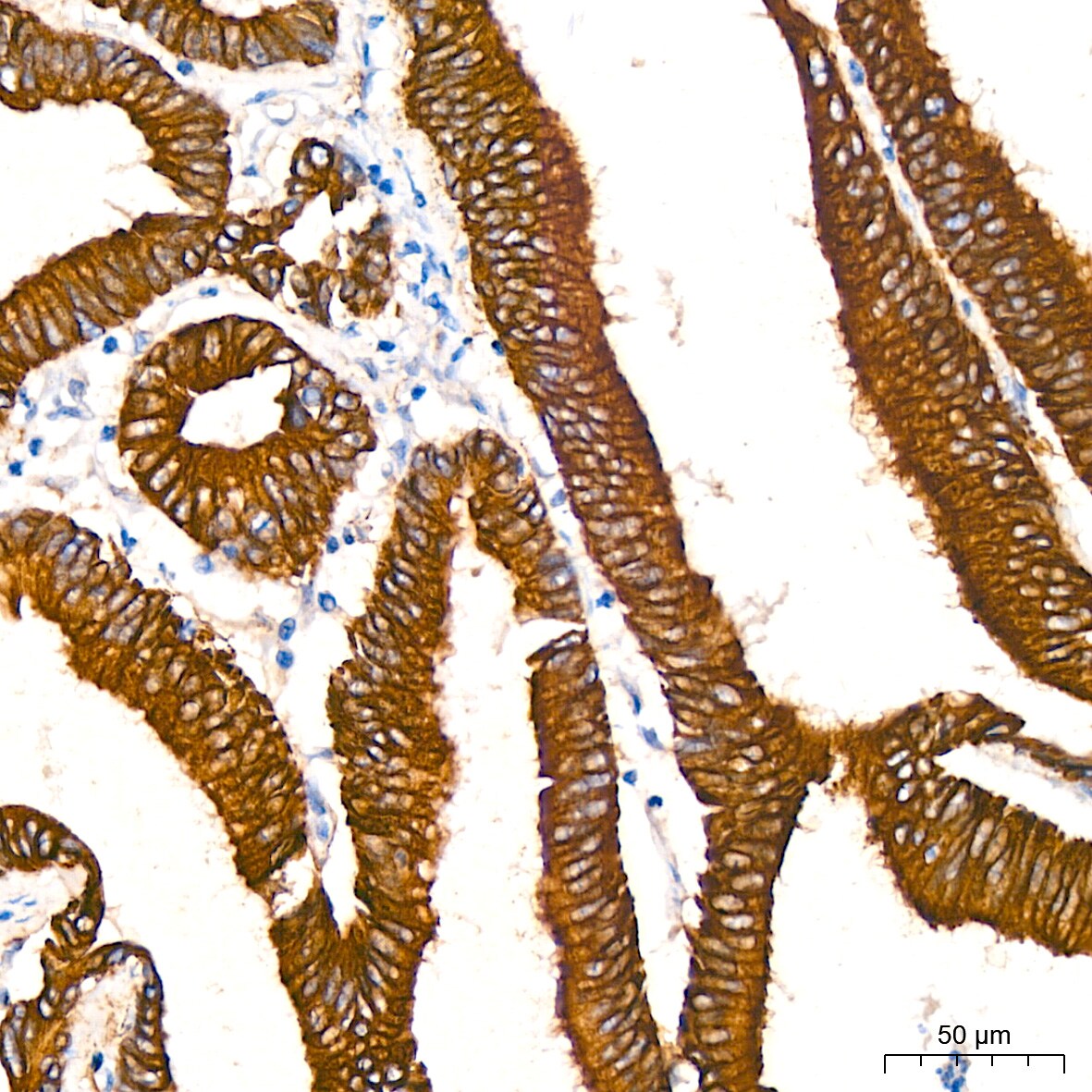 ATG5 Antibody (8L7X6)