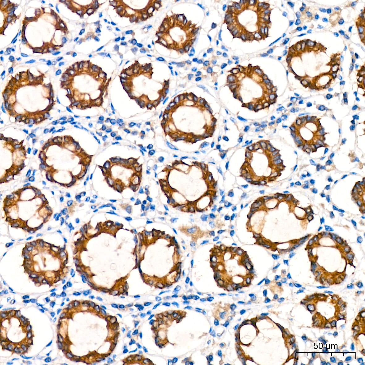 ATG5 Antibody (8L7X6)
