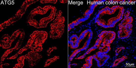 ATG5 Antibody (8L7X6)