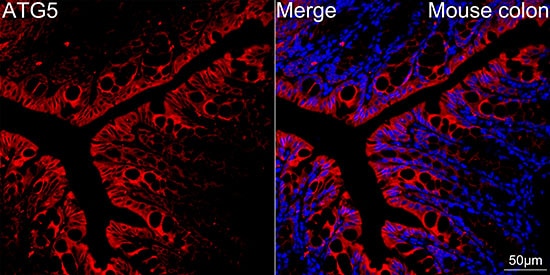 ATG5 Antibody (8L7X6)