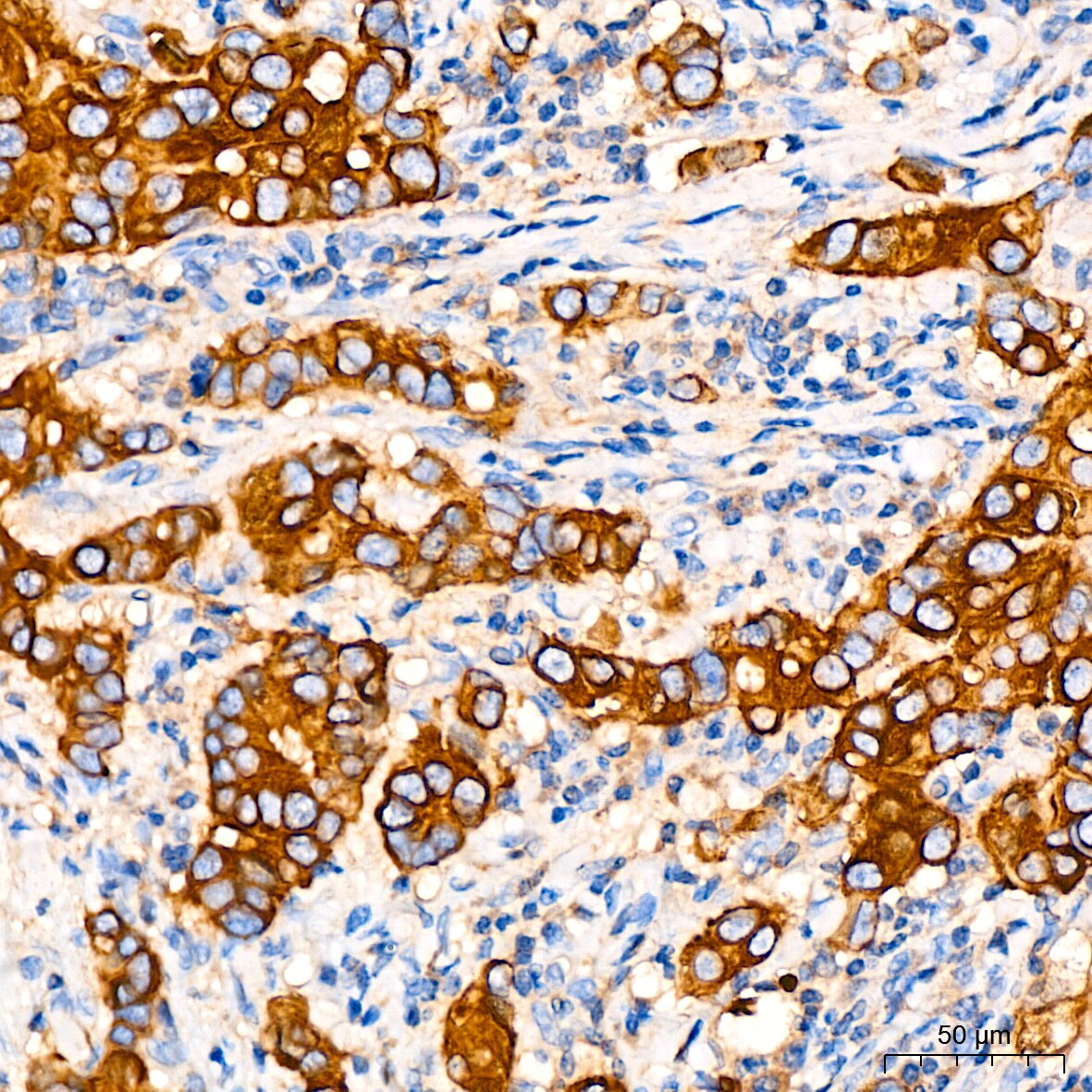 ATG5 Antibody (8L7X6)