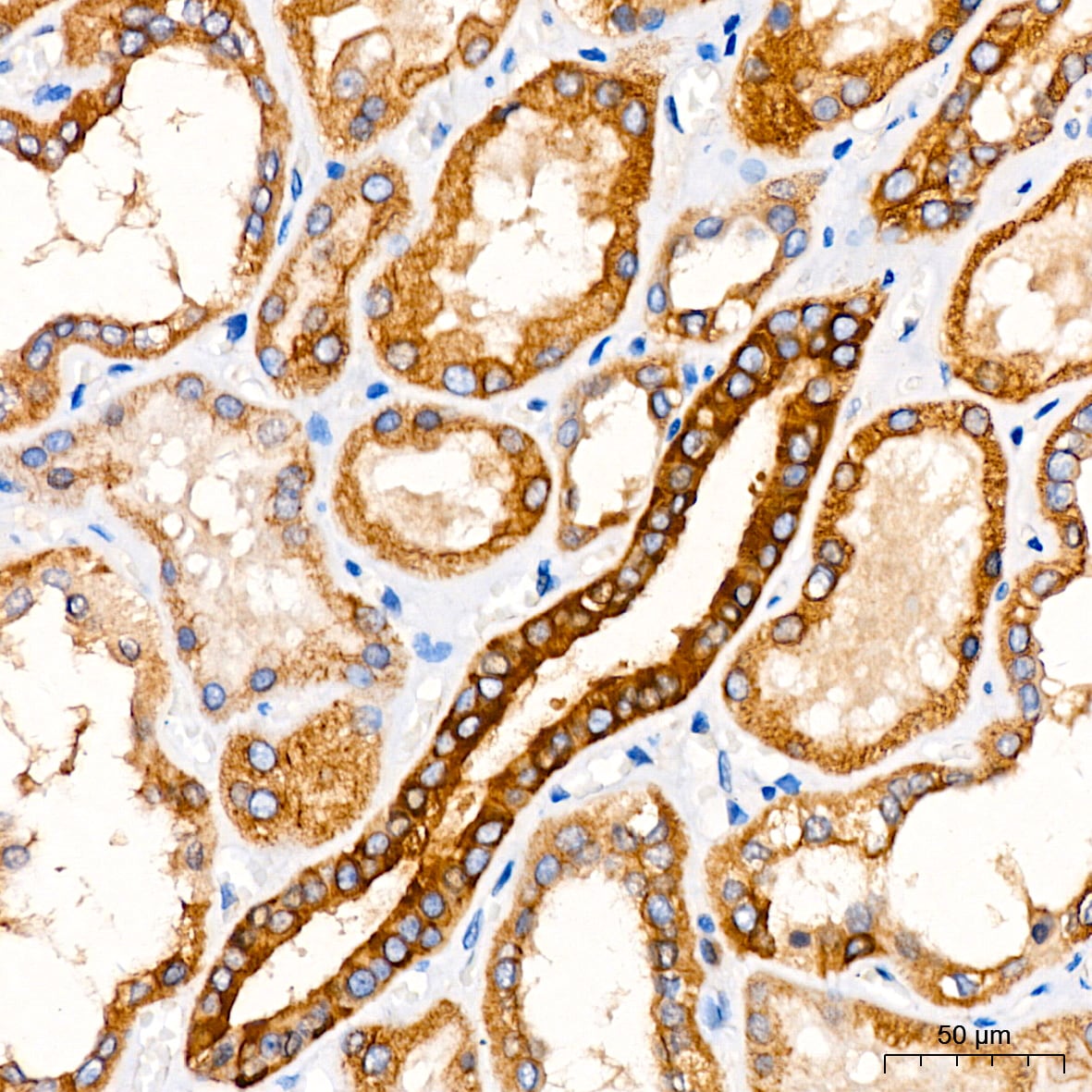 ATG5 Antibody (8L7X6)