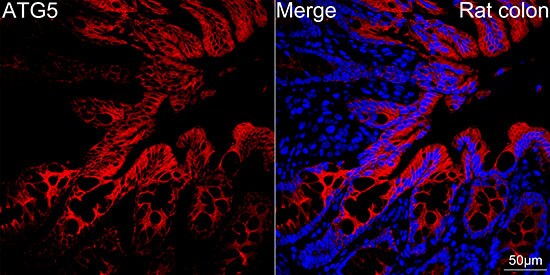 ATG5 Antibody (8L7X6)