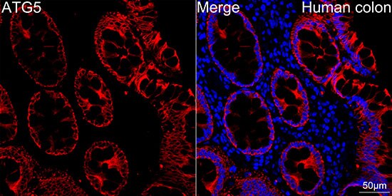 ATG5 Antibody (8L7X6)