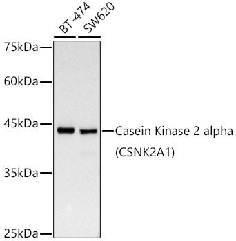 Casein Kinase 2 alpha Antibody (2P3M7)