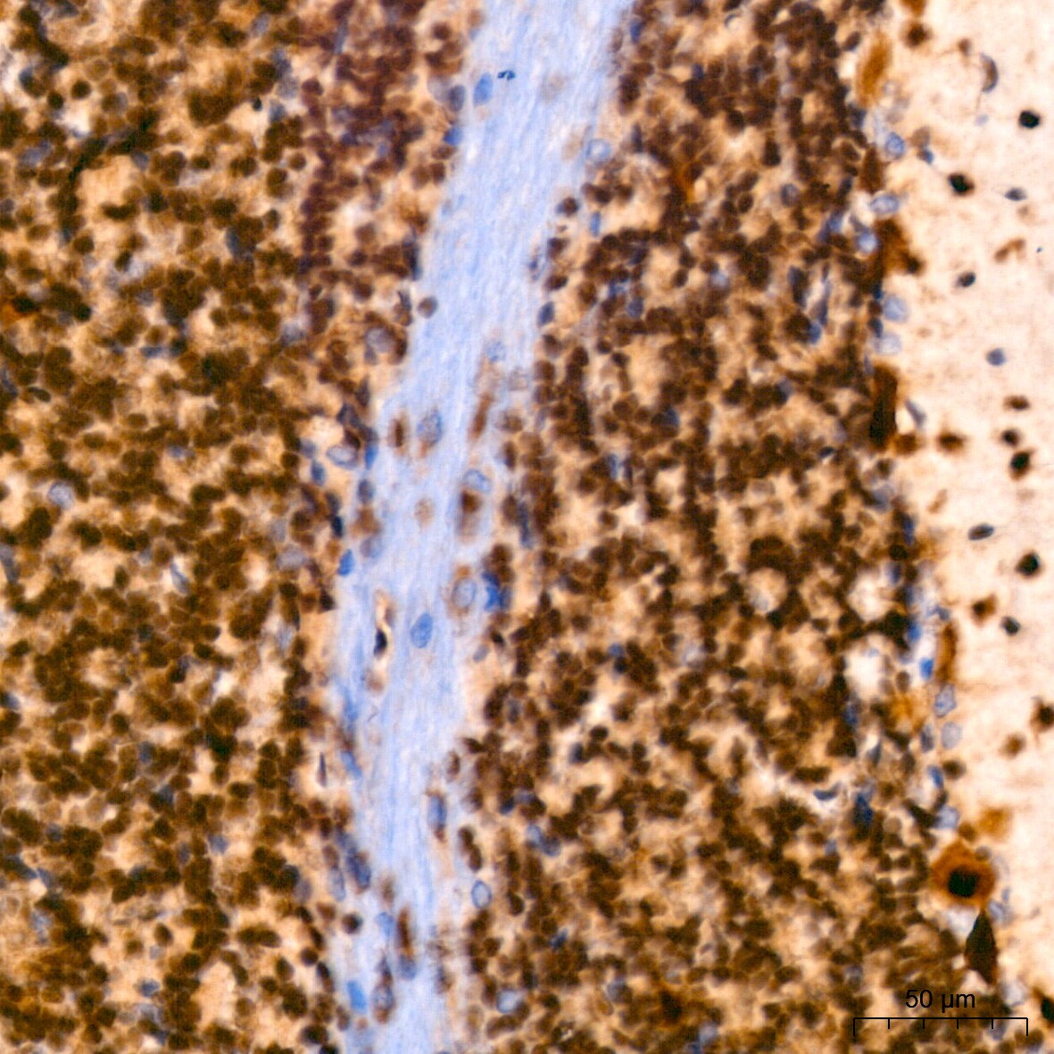 PIM1 Antibody (4C8D0)