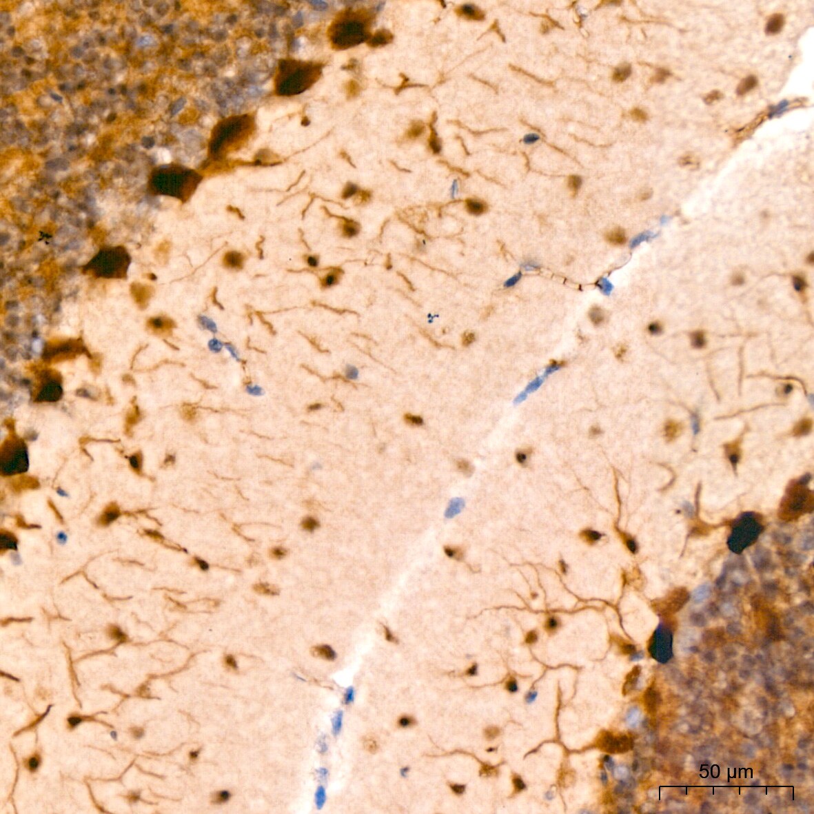 PIM1 Antibody (4C8D0)
