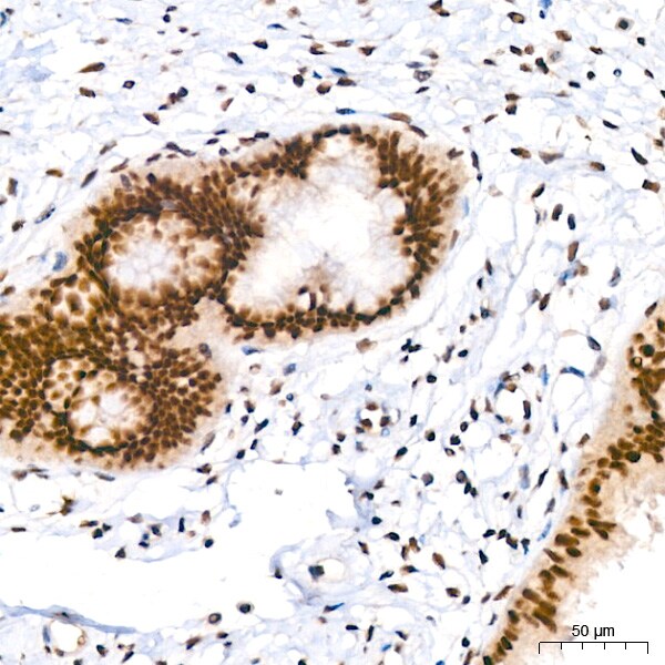 PIM1 Antibody (4C8D0)