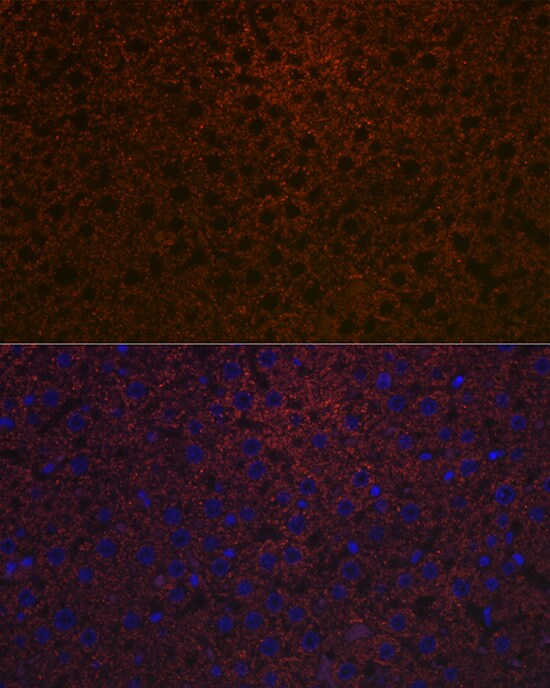 Ceruloplasmin Antibody (6C3K9)
