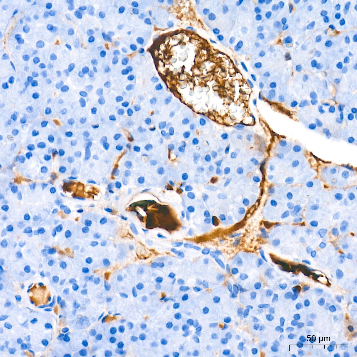 Ceruloplasmin Antibody (6C3K9)