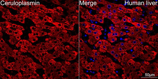 Ceruloplasmin Antibody (6C3K9)