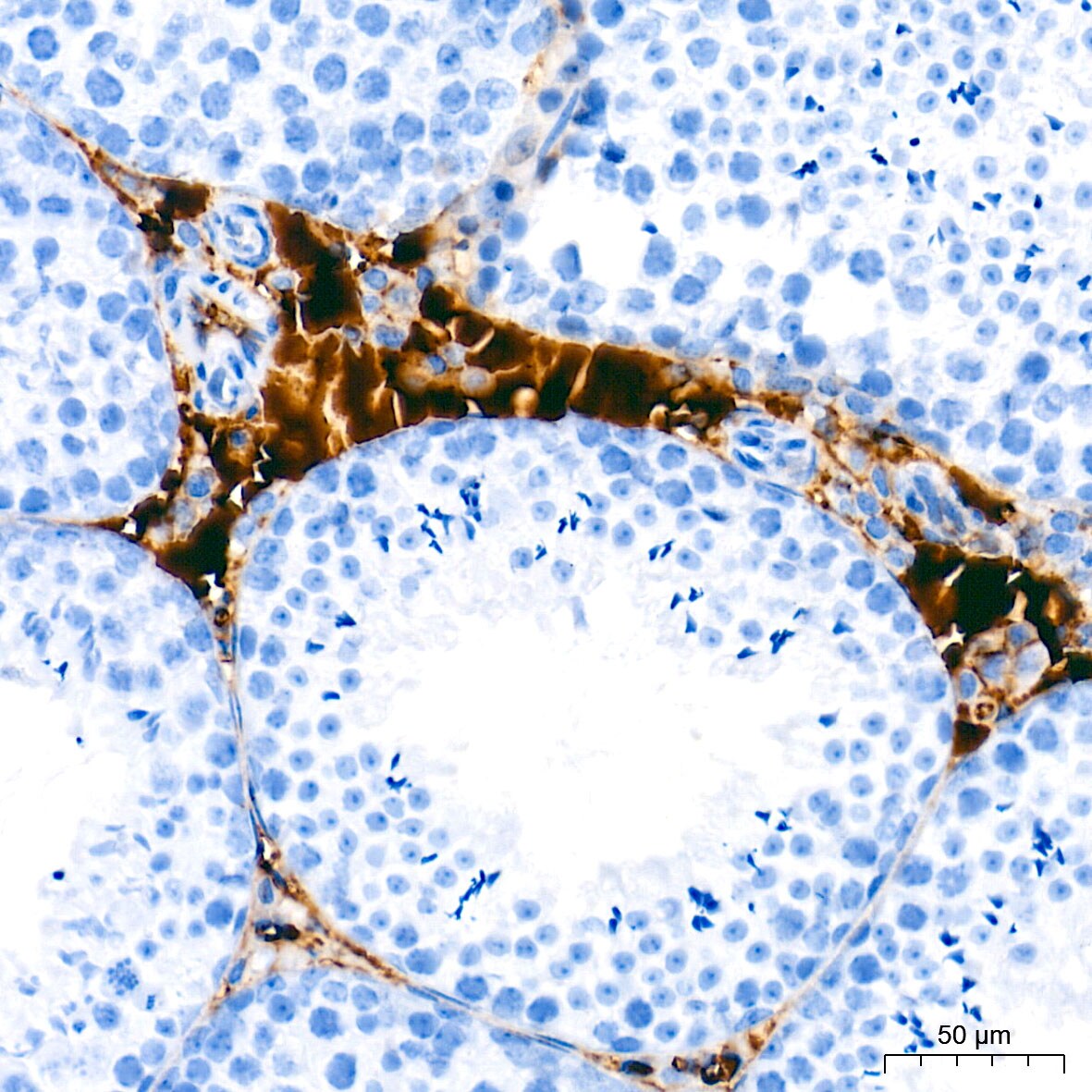Ceruloplasmin Antibody (6C3K9)
