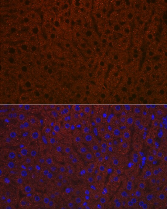 Ceruloplasmin Antibody (6C3K9)