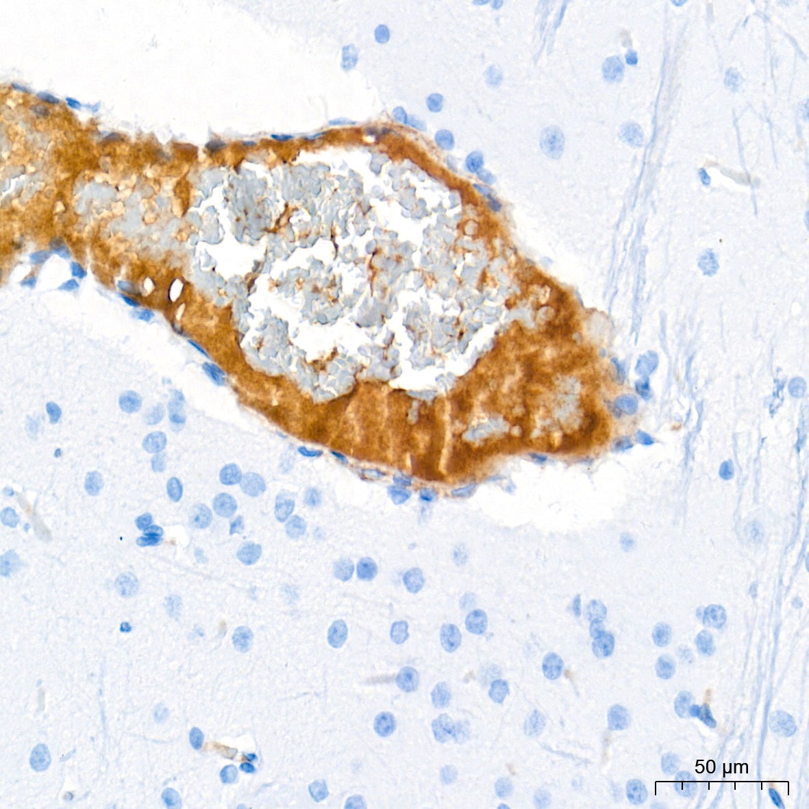 Ceruloplasmin Antibody (6C3K9)