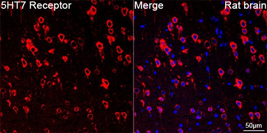 5-HT7 Antibody (4E6D2)