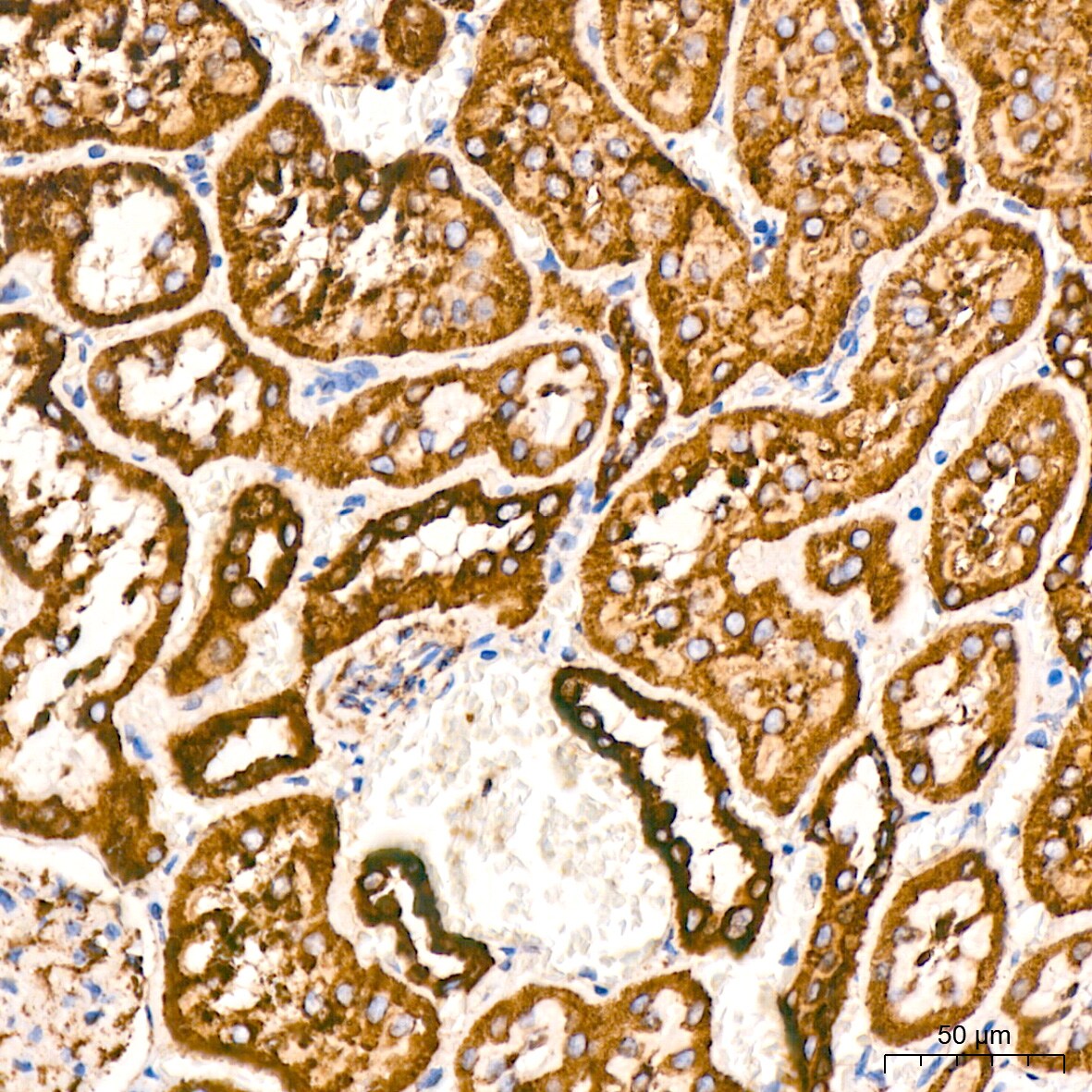 VDAC1 Antibody (6B1K1)