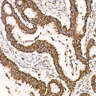 VDAC1 Antibody (6B1K1)