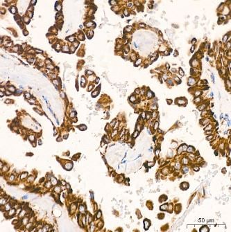 VDAC1 Antibody (6B1K1)