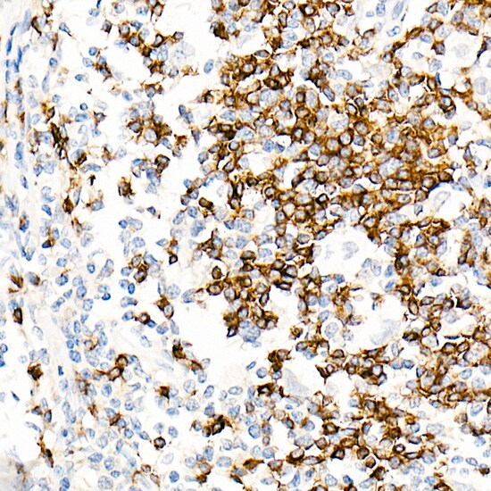 IGHD Antibody (5M8U3)