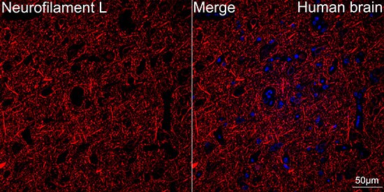 NF-L Antibody (3L9Y10) - Azide and BSA Free