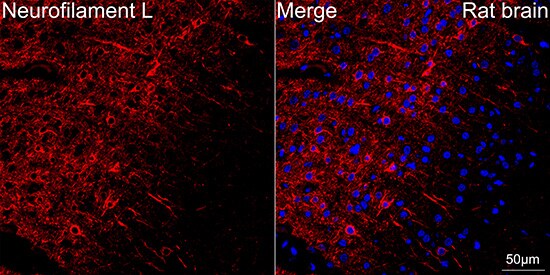 NF-L Antibody (3L9Y10) - Azide and BSA Free