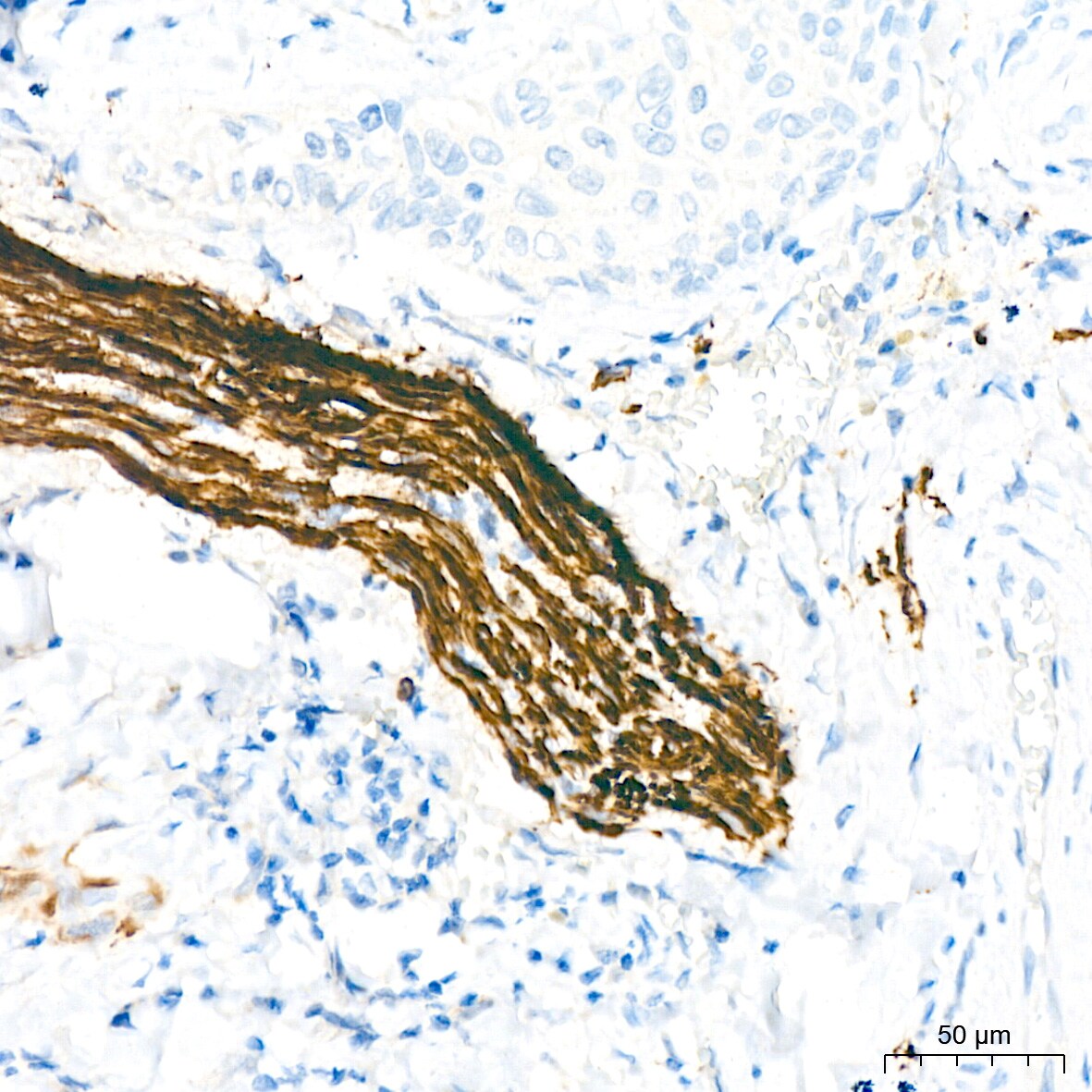 NF-L Antibody (3L9Y10) - Azide and BSA Free
