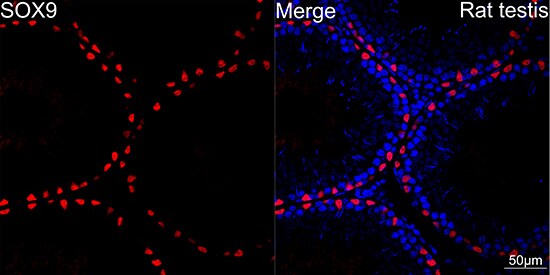 SOX9 Antibody (5Y4J8)