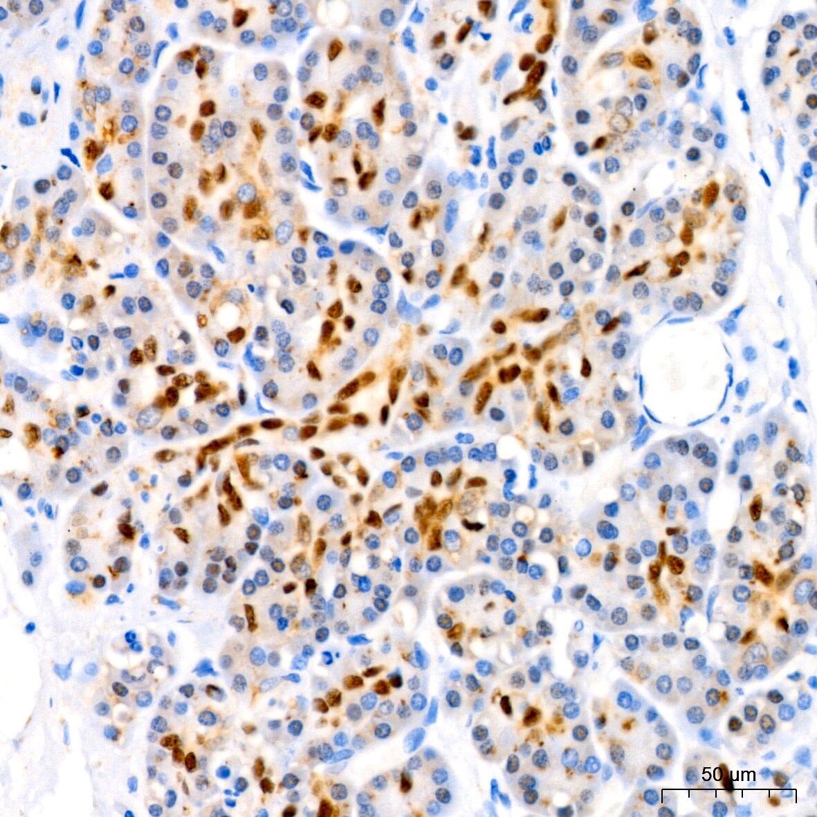 SOX9 Antibody (5Y4J8)