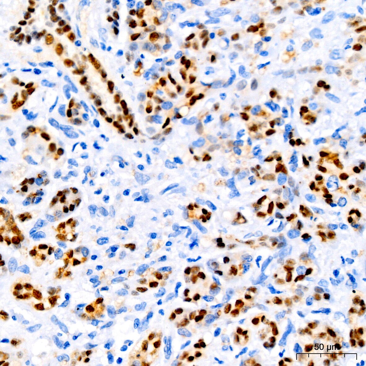 SOX9 Antibody (5Y4J8)