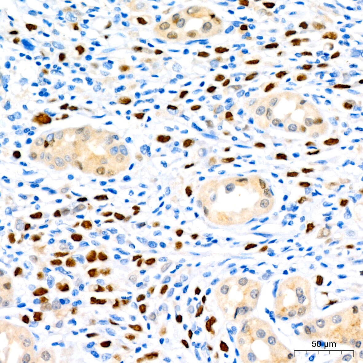 SOX9 Antibody (5Y4J8)
