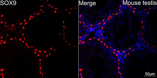 SOX9 Antibody (5Y4J8)