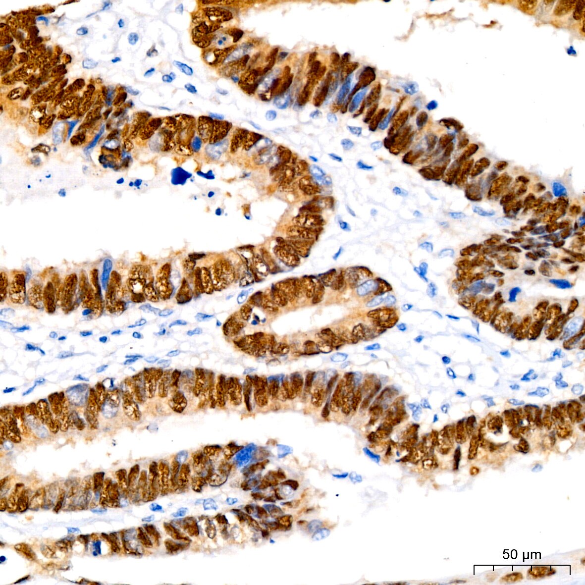 SOX9 Antibody (5Y4J8)