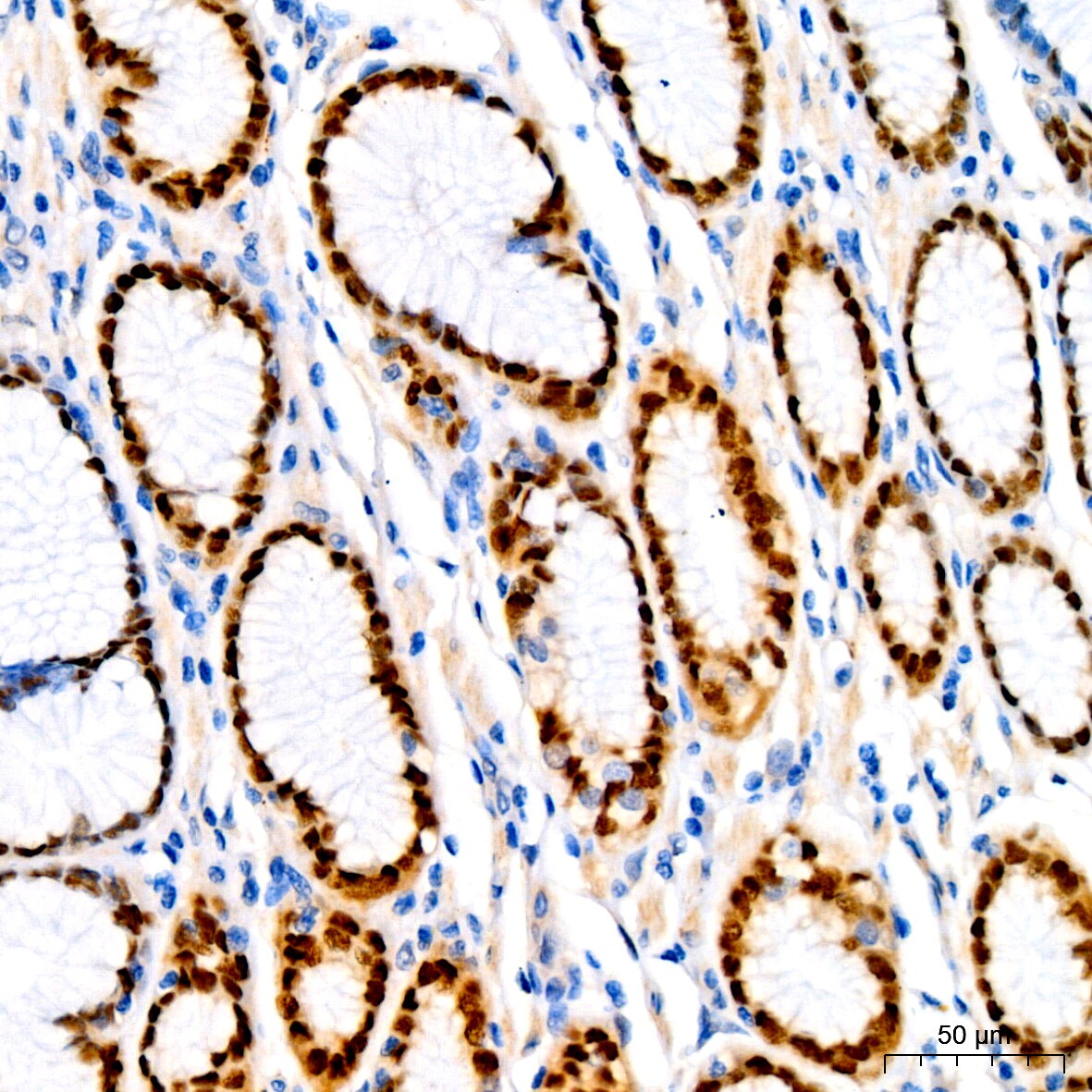 SOX9 Antibody (5Y4J8)