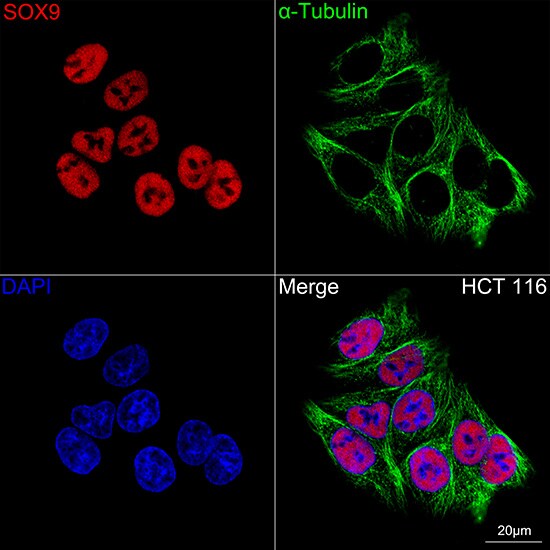 SOX9 Antibody (5Y4J8)
