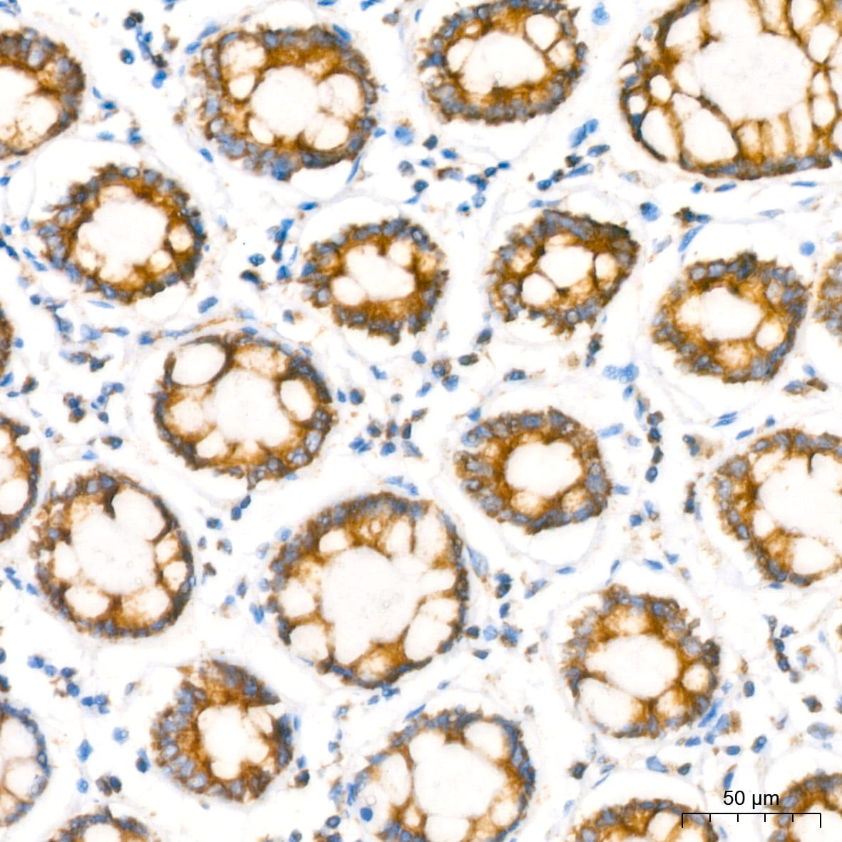 NDUFB8 Antibody (6T8G1)