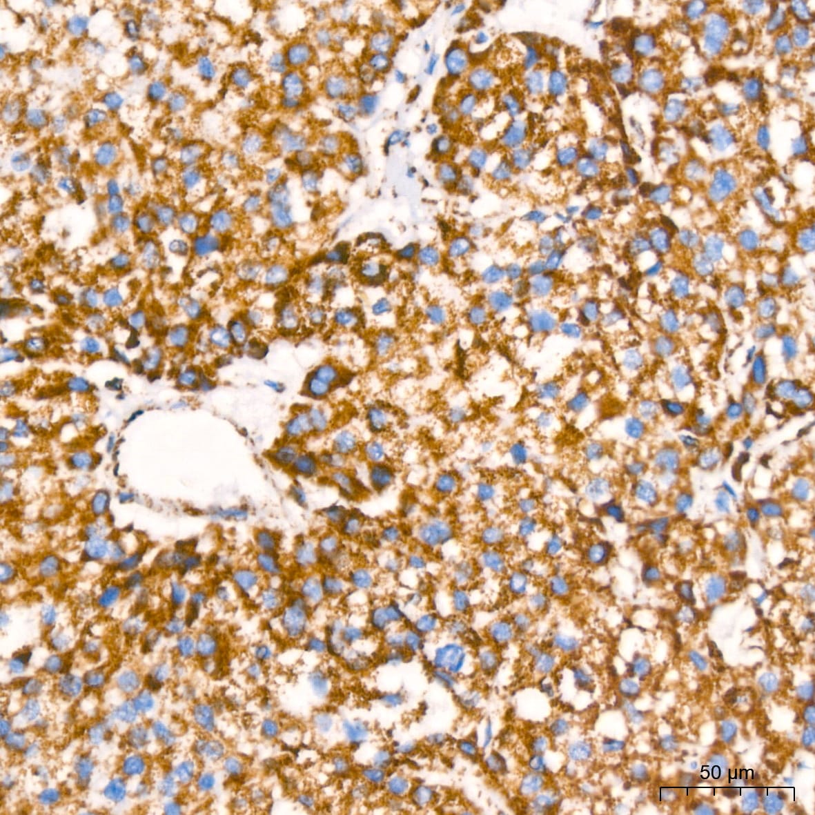 NDUFB8 Antibody (6T8G1)