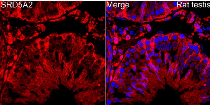 SRD5A2 Antibody (8A4H5)