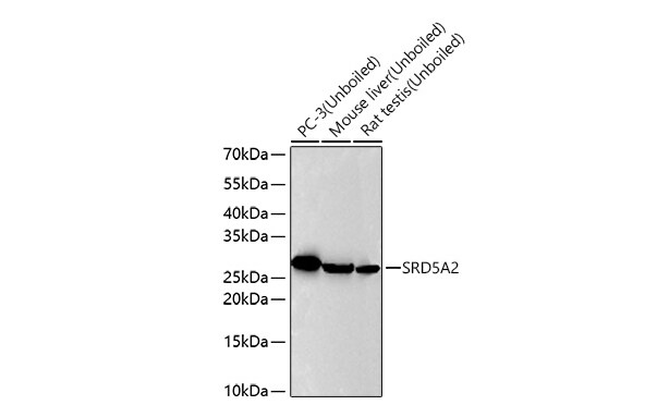 SRD5A2 Antibody (8A4H5)
