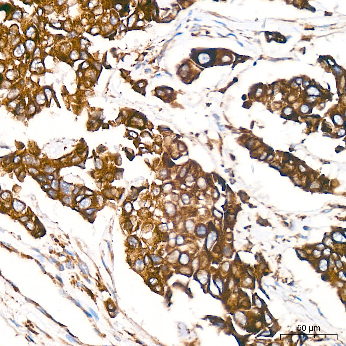 ERP29 Antibody (1J0D3)