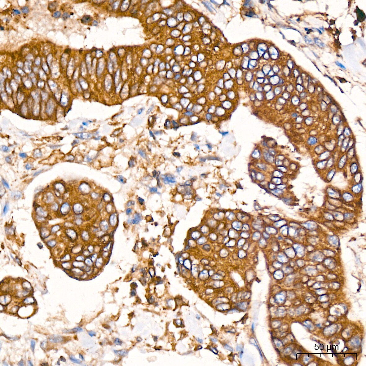 ERP29 Antibody (1J0D3)