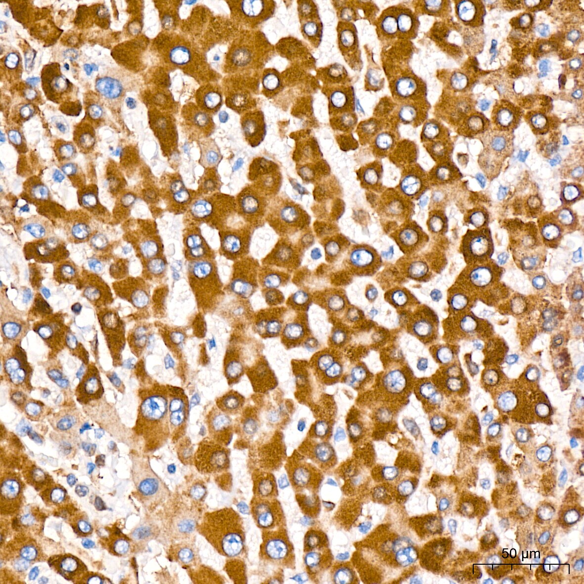ERP29 Antibody (1J0D3)