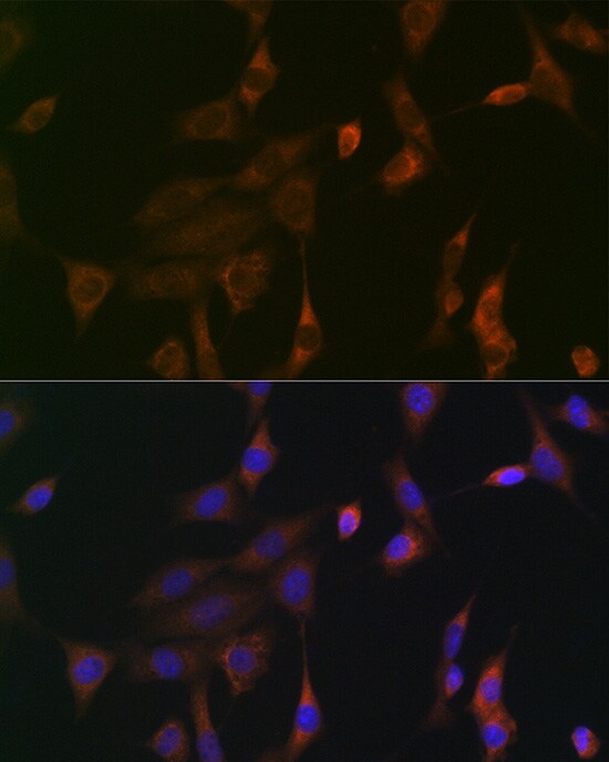 Ras Antibody (6J9I4)