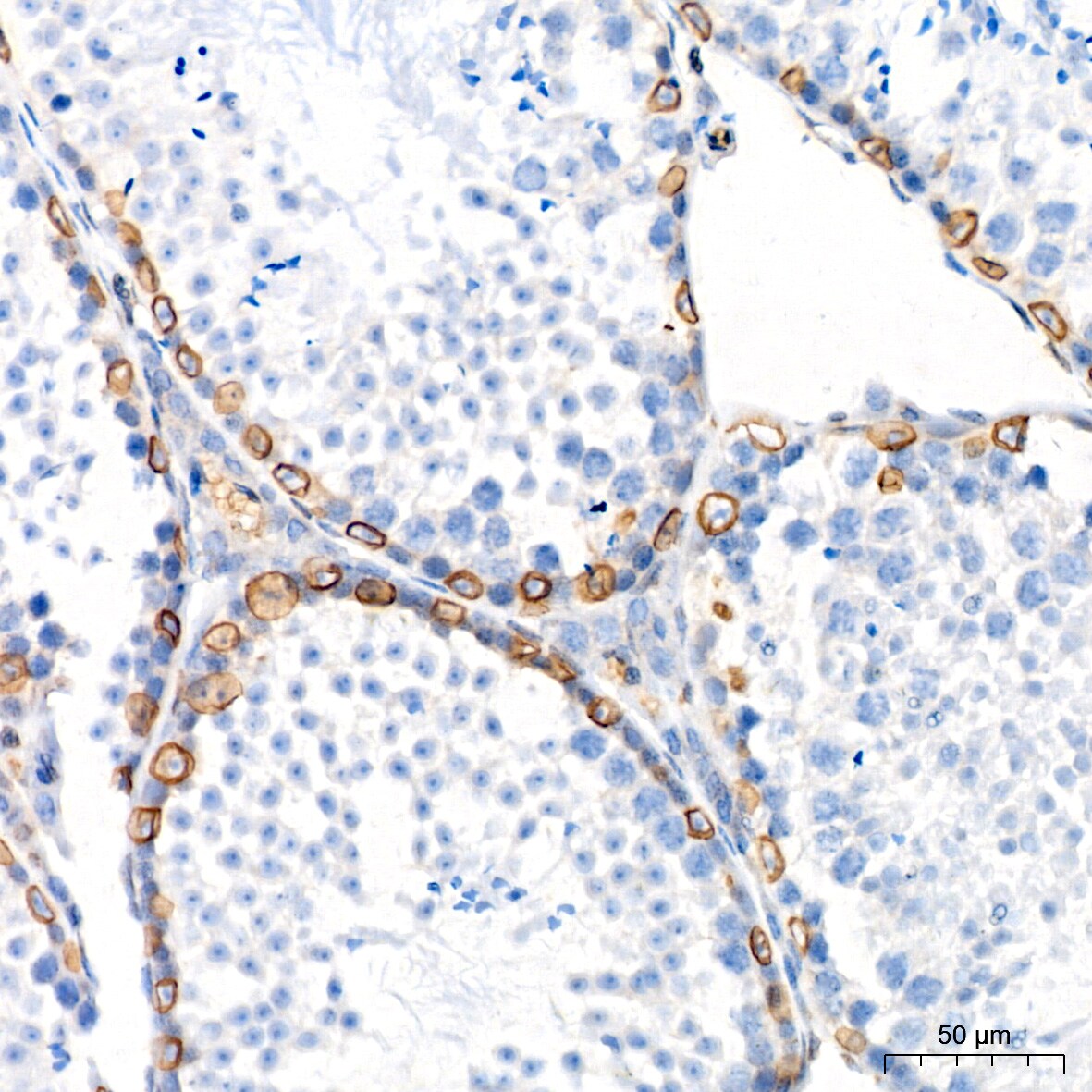 UNC84B Antibody (8E8D7)