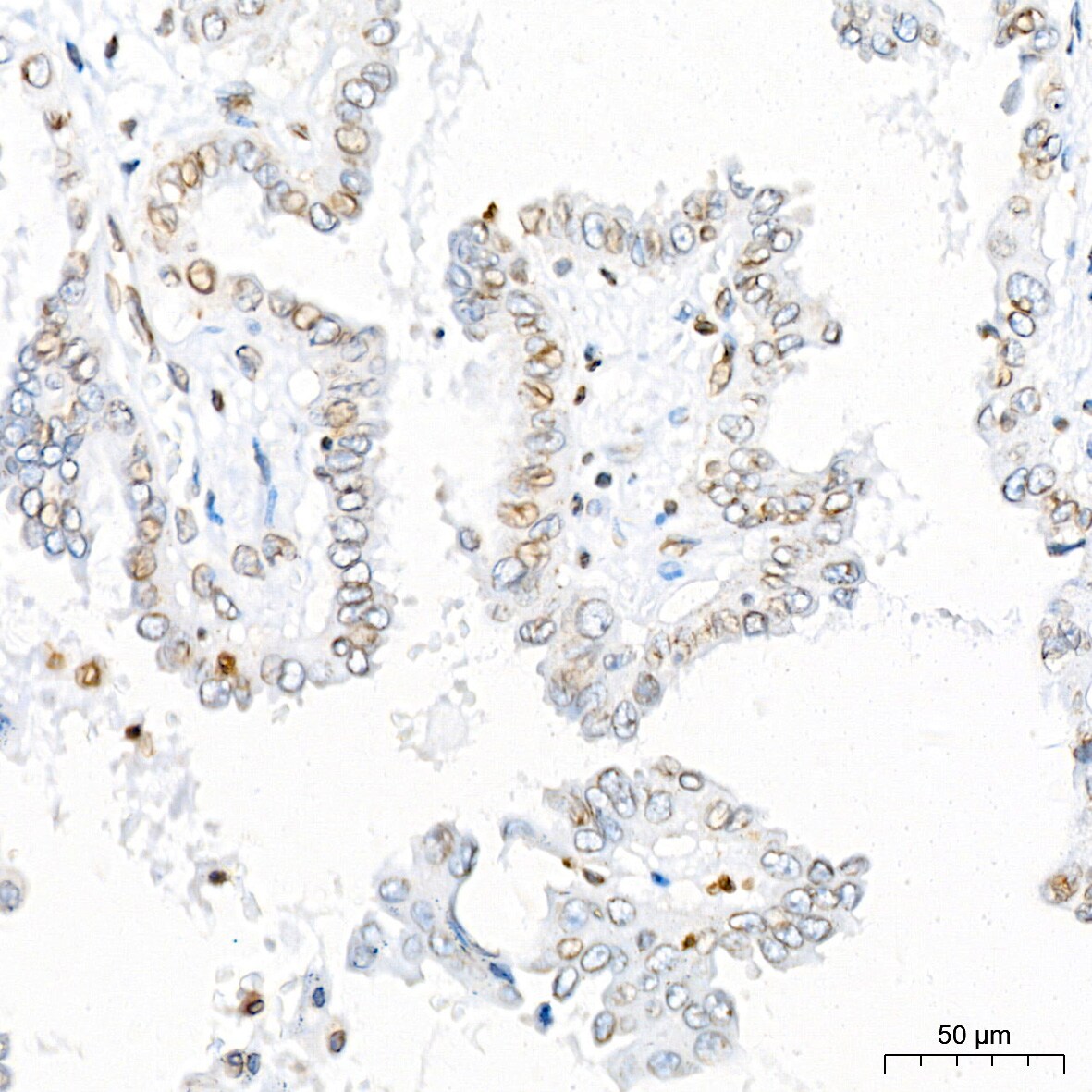 UNC84B Antibody (8E8D7)