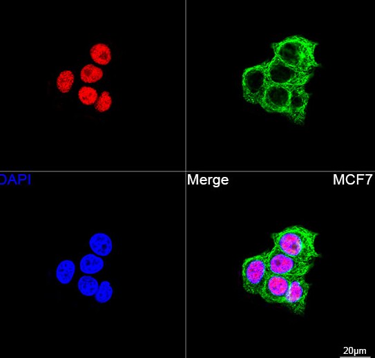 ZBTB7A/Pokemon Antibody (3T2J1)