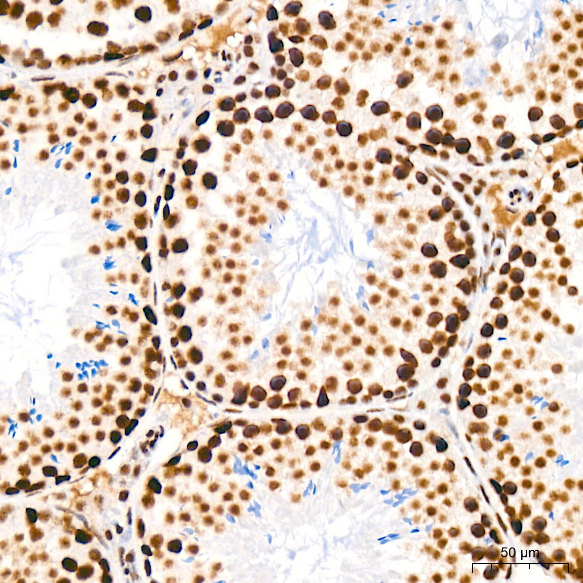 CDC40 Antibody (2I8I7)